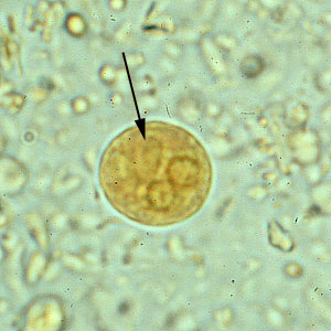 protozoare helminthiases