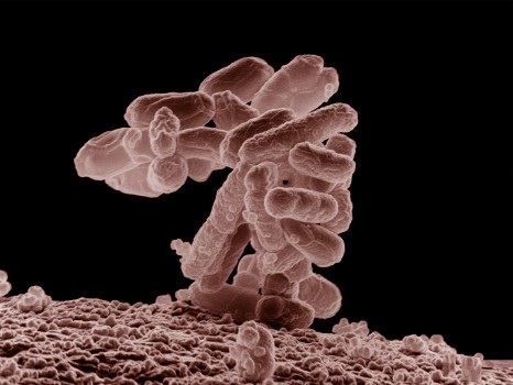 Escherichia coli. Foto: Eric Erbe / USDA