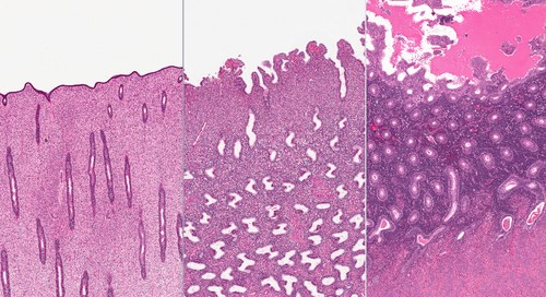 Três estágios do endométrio: folicular, luteal e menstrual. Ilustração: vetpathologist / Shutterstock.com