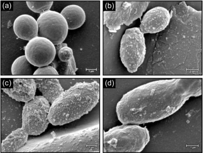 Candida albicans. Foto: NLM / NIH (CC-BY-SA 3.0)