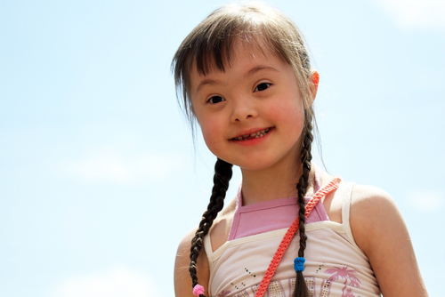 Menina portadora da Síndrome de Down. Foto: Denis Kuvaev / Shutterstock.com