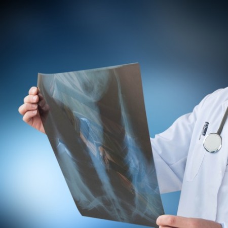 Médico examinando uma radiografia. Foto: MorganStudio / Shutterstock.com