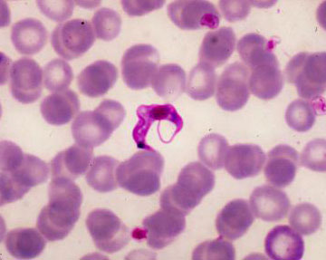 Trypanosoma cruzi. Foto: Dr. Mae Melvin / CDC [public domain]