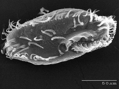 Oxytricha trifallax. Foto: Genome.gov / [Public domain]