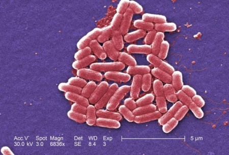 Escherichia coli, bactéria presente na flora intestinal. Foto: Janice Haney Carr / CDC