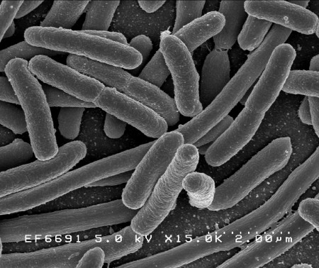 Escherichia coli. Foto: NIAID / NIH