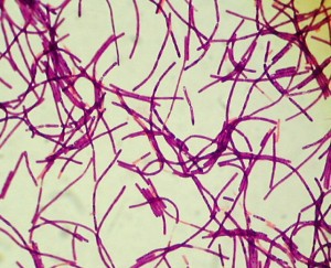 Bacillus anthracis