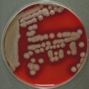 bacillus cereus