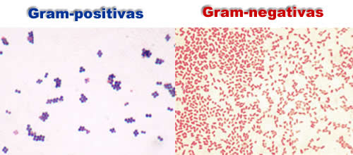 Bactérias gram-positivas e gram-negativas. Fotos: Y_tambe / Wikimedia Commons (1, 2) [CC-BY-SA 3.0]