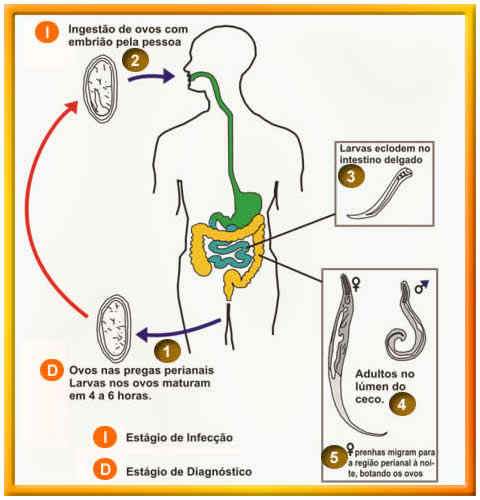 sintomas de enterobiasis