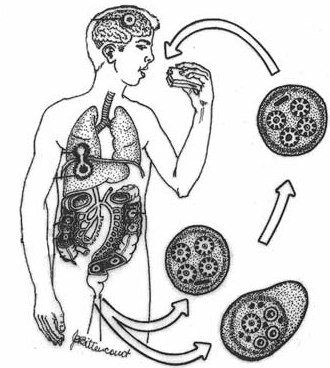 Giardia scaun galben, Giardia infectie Pagina 6