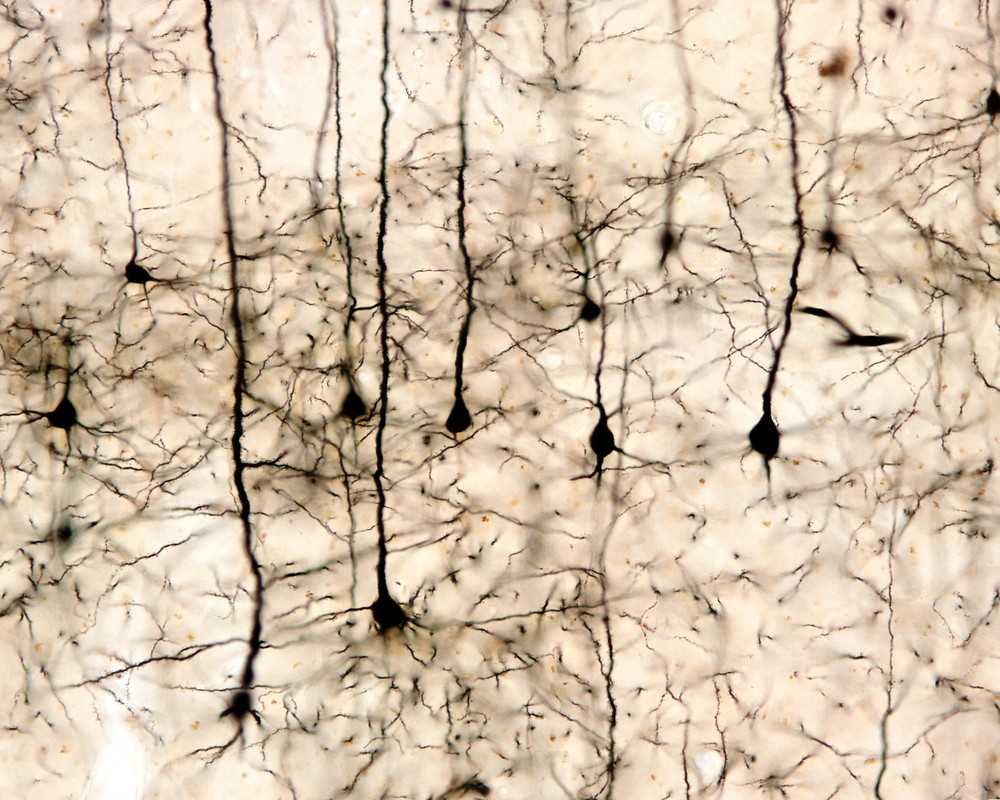 Figura 2: Neurônios do córtex cerebral visualizados com microscópio. Foto: Jose Luis Calvo / Shutterstock.com
