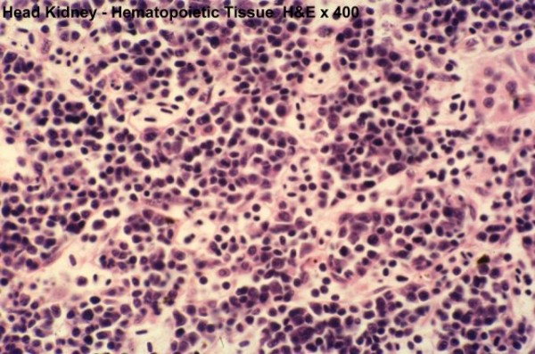 Tecido Hematopoiético - Histologia - InfoEscola