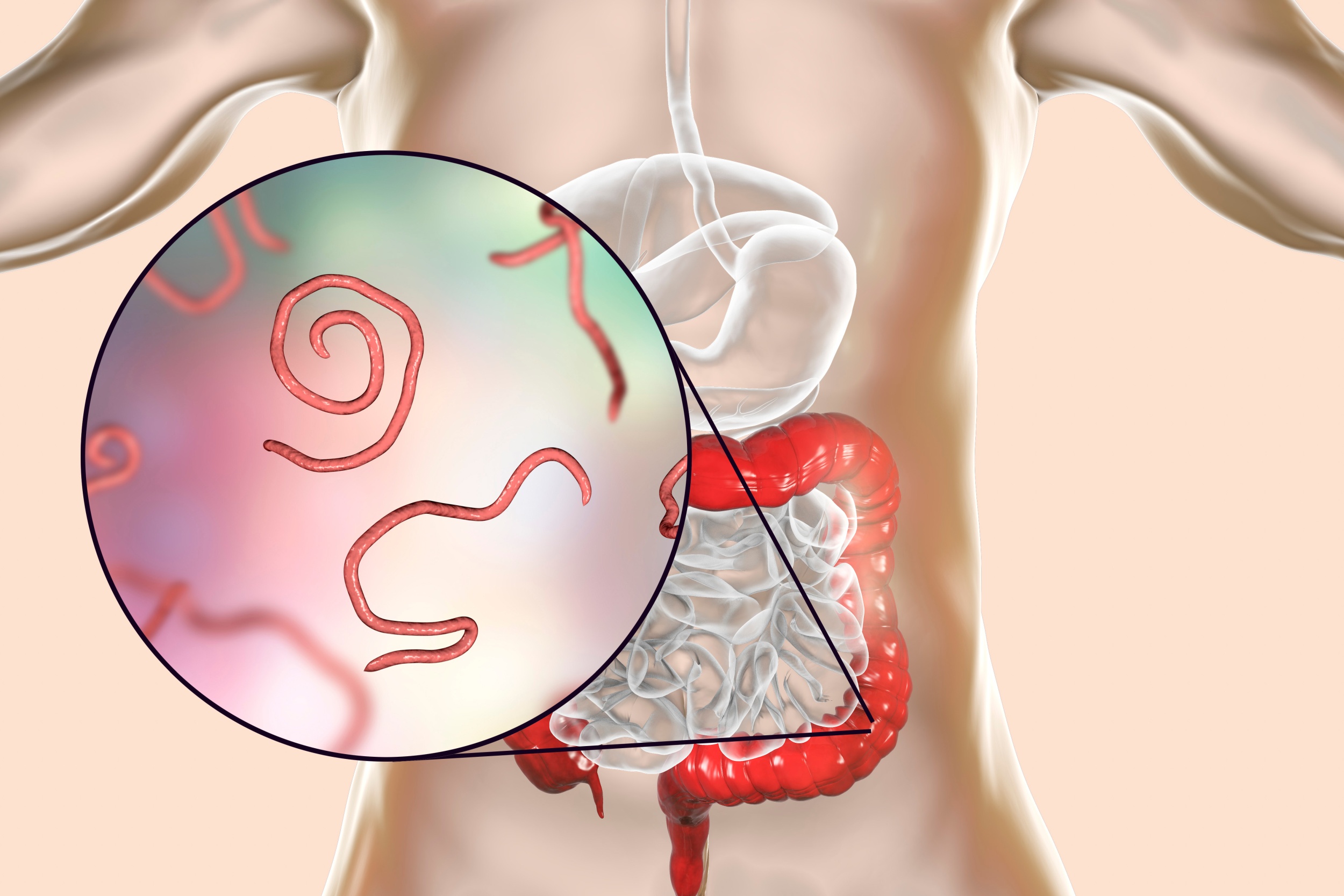 tratamentul paraziților la tablete umane symptoms of toxins in liver