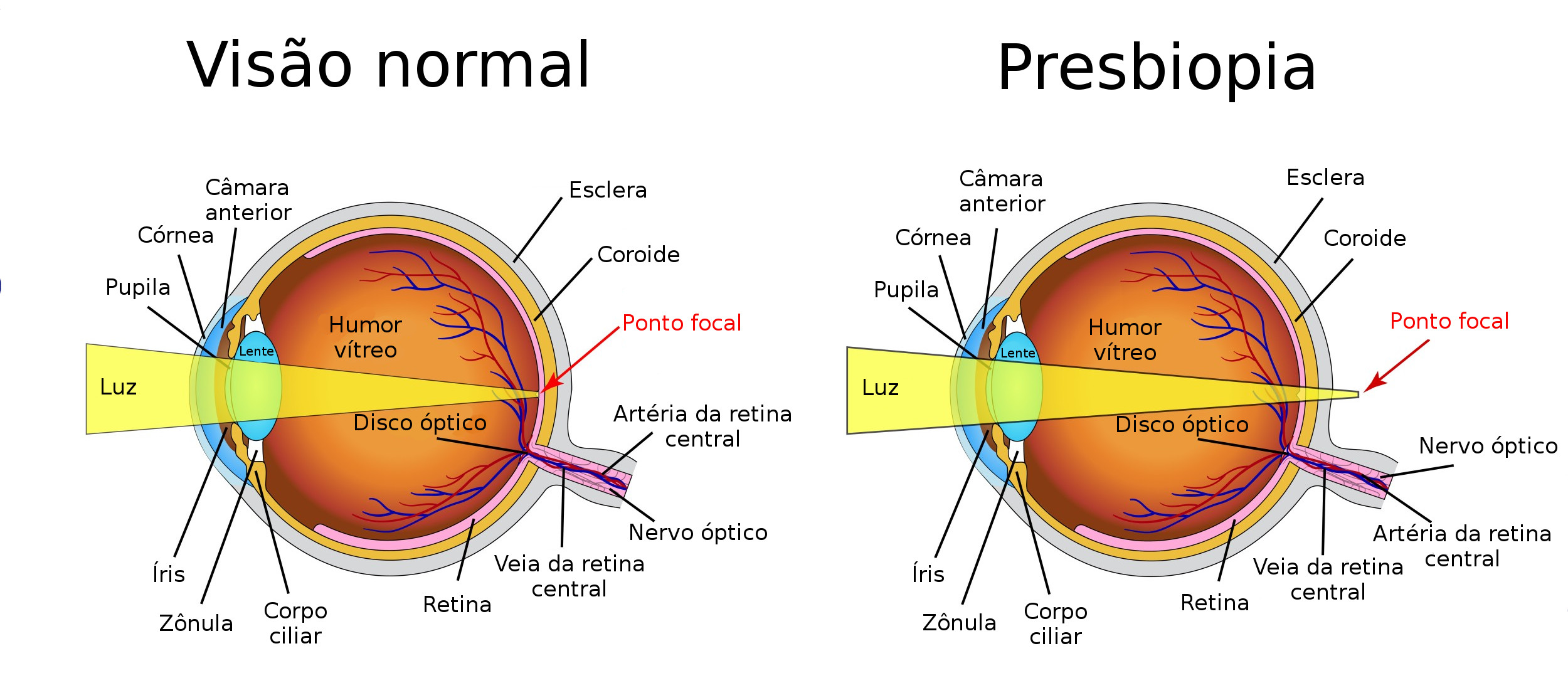 Presbiopia: O que é e por que temos esse problema na visão?