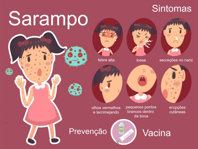 Sarampo - transmissão, sintomas, tratamento, prevenção - InfoEscola