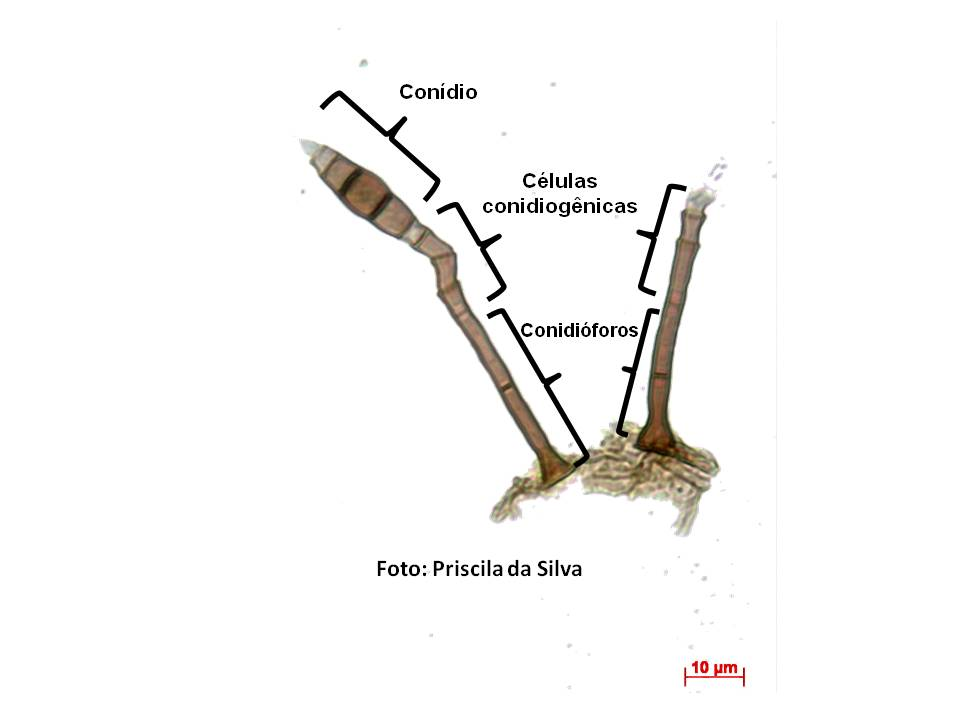 Exemplo de conidioma de um fungo anamórfico (forma assexuada).