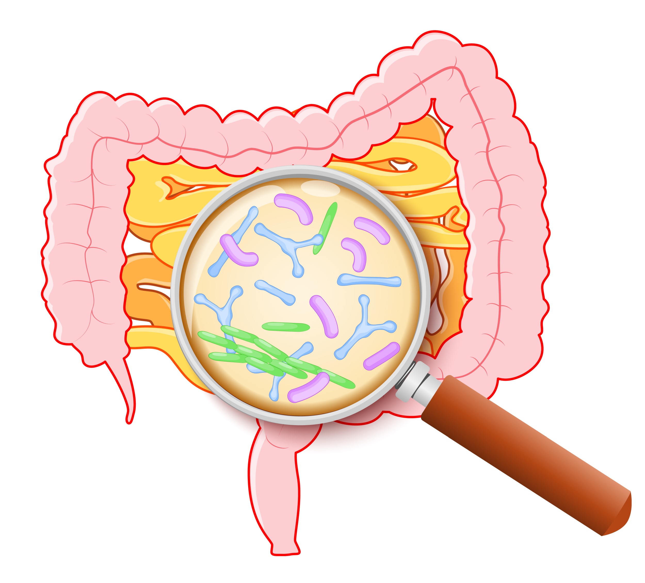 Como acabar com gases intestinais. 